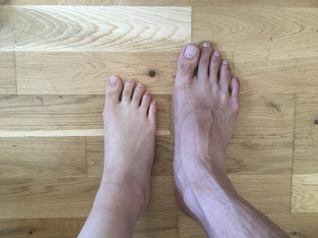 旦那の オバケ足 の話 おつかれさまです 若菜です 旦那と２人で会社辞めてスコットランドにいます