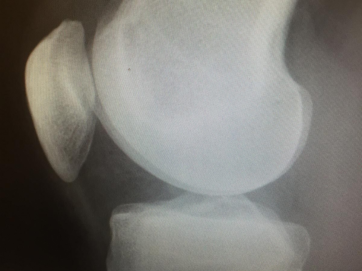f:id:wakaru-web:20210307152212j:plain