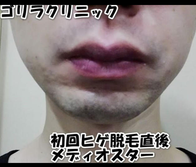 １回目メディオスター