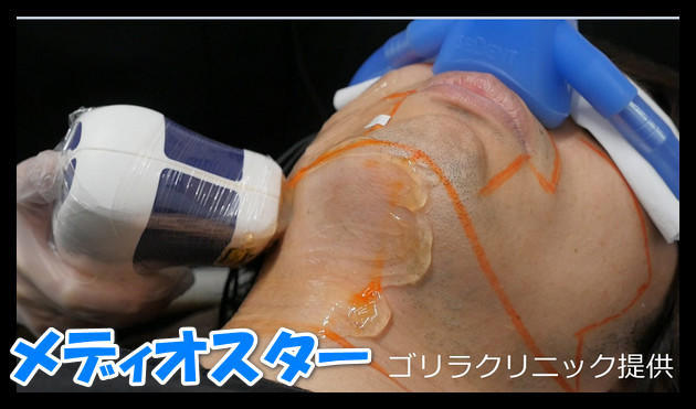 f:id:wakuwakusetuyaku:20210904000612j:plain