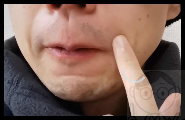 ８回目メディオスターから２ヶ月経過の効果