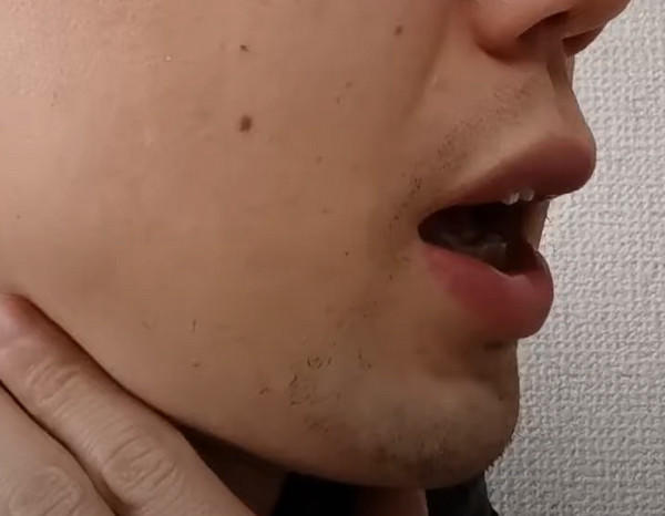 ７回目のメディオスターから２ヶ月経過