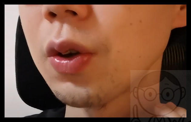 ８回目のメディオスターから２ヶ月経過