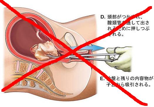 f:id:warai88waraikun:20200119030611j:plain f:id:warai88waraikun:20200119030611j:plain