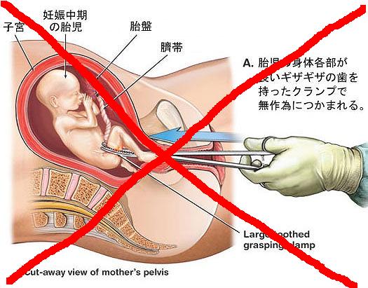 f:id:warai88waraikun:20200119030920j:plain f:id:warai88waraikun:20200119030920j:plain