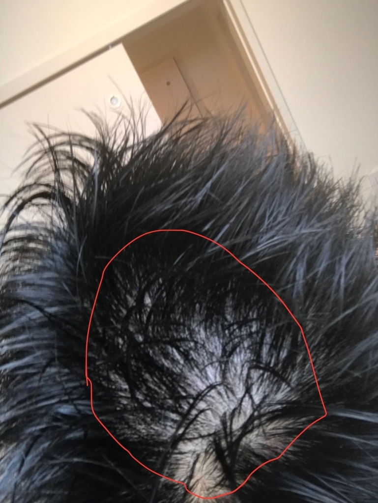 f:id:wataru3878:20180529003758j:plain