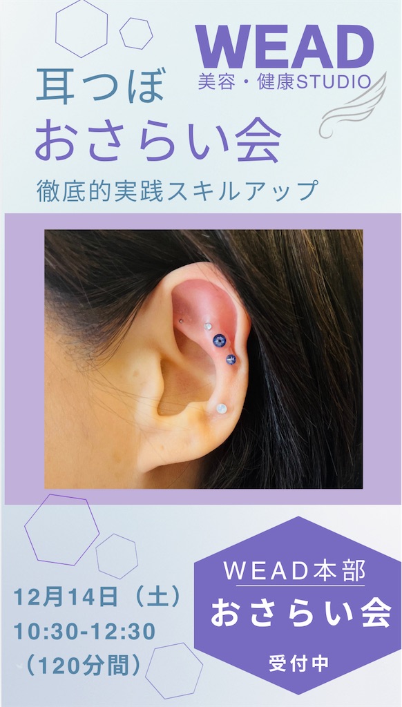 残りわずか】耳つぼシール 300粒