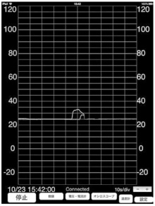 f:id:weed_7777:20160722174911j:plain