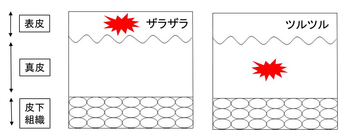 皮膚科診断学の図