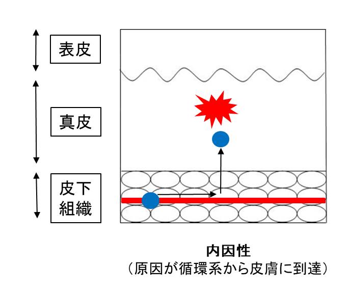 医師国家試験薬疹の図