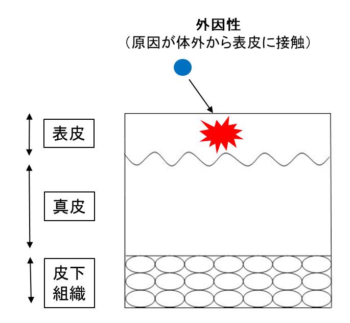 医師国家試験湿疹の図