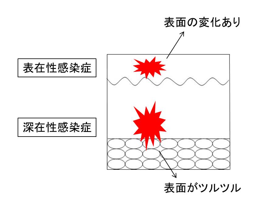 医師国家試験感染症の皮疹の図