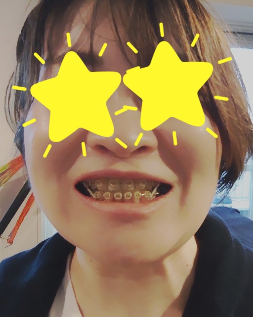 f:id:whitesan1106:20210904155549j:image f:id:whitesan1106:20210904155549j:image