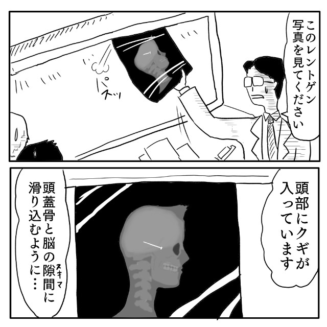 f:id:wide-tree:20240928202433j:image