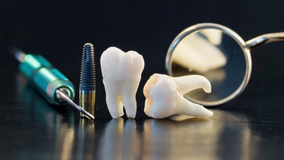 f:id:wisdomtoothpainrelief091:20171119084323j:plain f:id:wisdomtoothpainrelief091:20171119084323j:plain