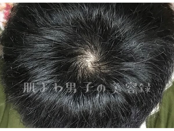f:id:wkldpiqbl:20200627204121j:plain f:id:wkldpiqbl:20200627204121j:plain