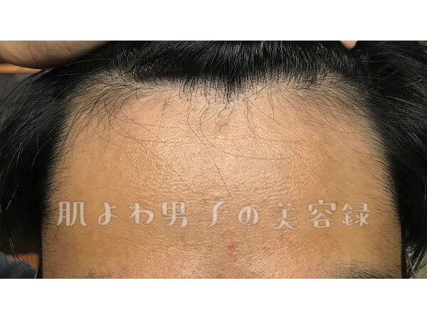 f:id:wkldpiqbl:20200627205739j:plain