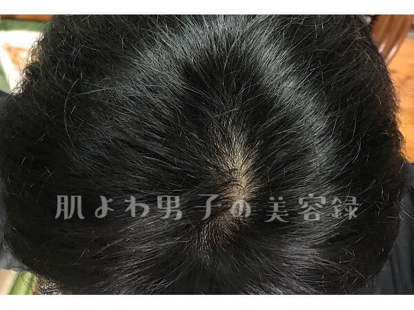 f:id:wkldpiqbl:20200627205743j:plain