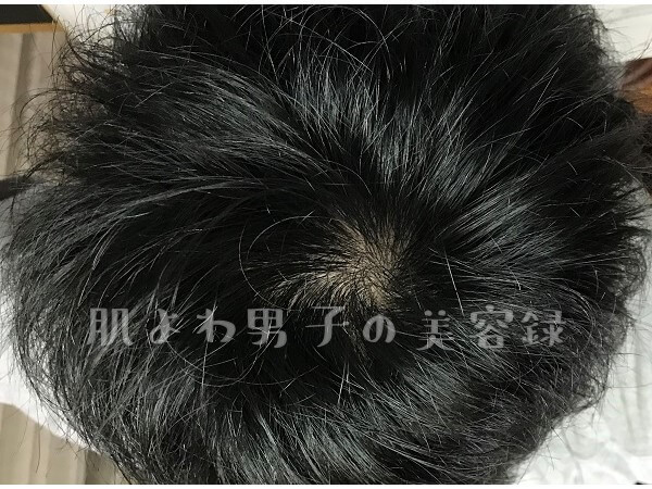 f:id:wkldpiqbl:20200627211007j:plain f:id:wkldpiqbl:20200627211007j:plain