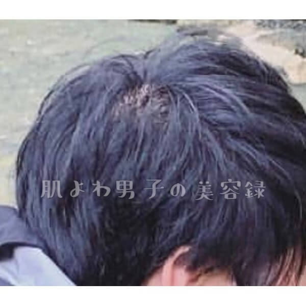f:id:wkldpiqbl:20200703214900j:plain f:id:wkldpiqbl:20200703214900j:plain