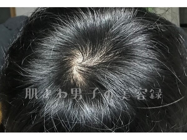 f:id:wkldpiqbl:20200913212840j:plain f:id:wkldpiqbl:20200913212840j:plain