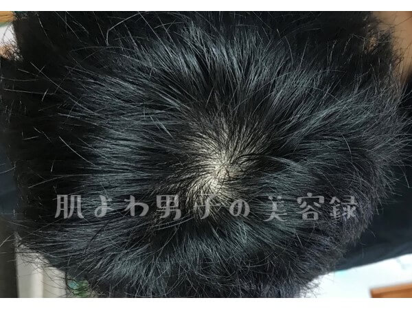f:id:wkldpiqbl:20201004204743j:plain f:id:wkldpiqbl:20201004204743j:plain