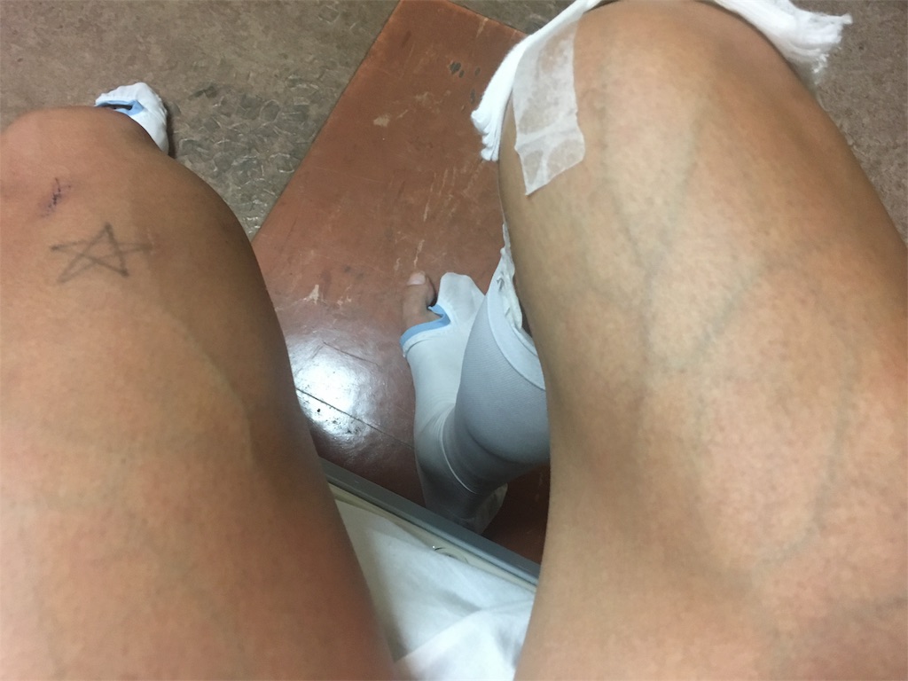 f:id:x_makocchi:20170508190049j:image f:id:x_makocchi:20170508190049j:image