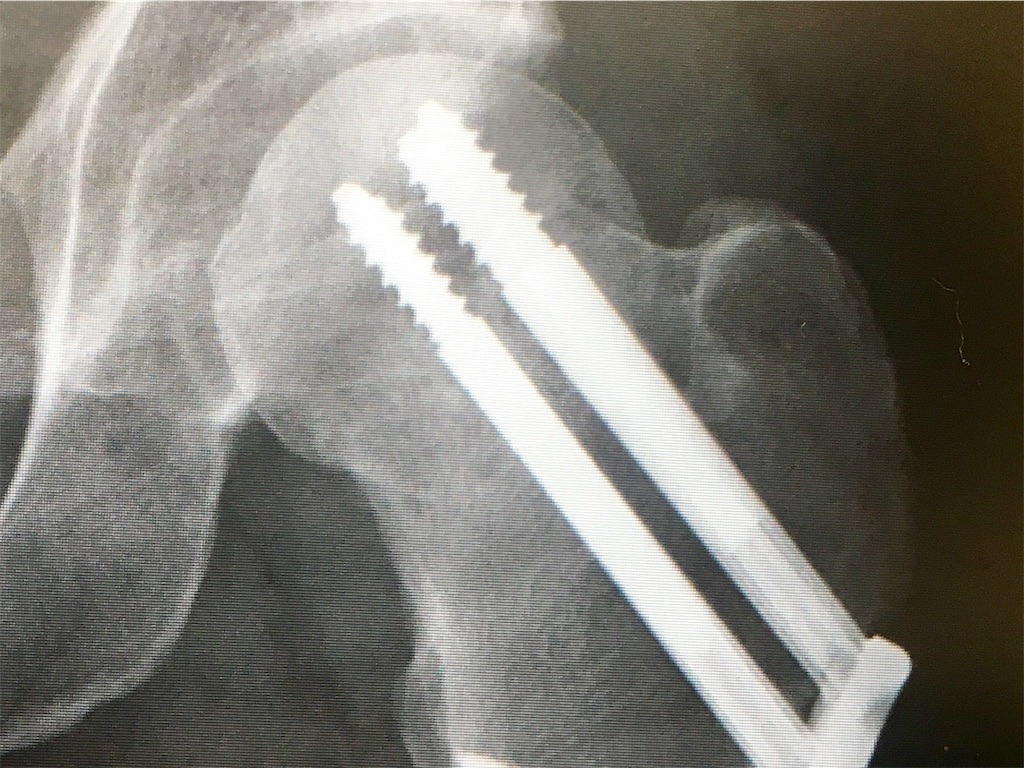 f:id:x_makocchi:20171205201944j:image