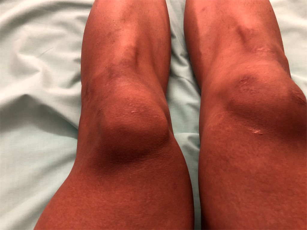 f:id:x_makocchi:20180908044106j:image