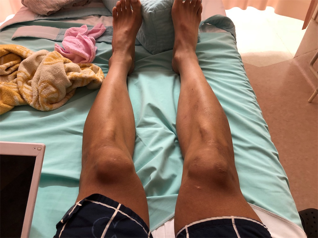 f:id:x_makocchi:20180908044141j:image