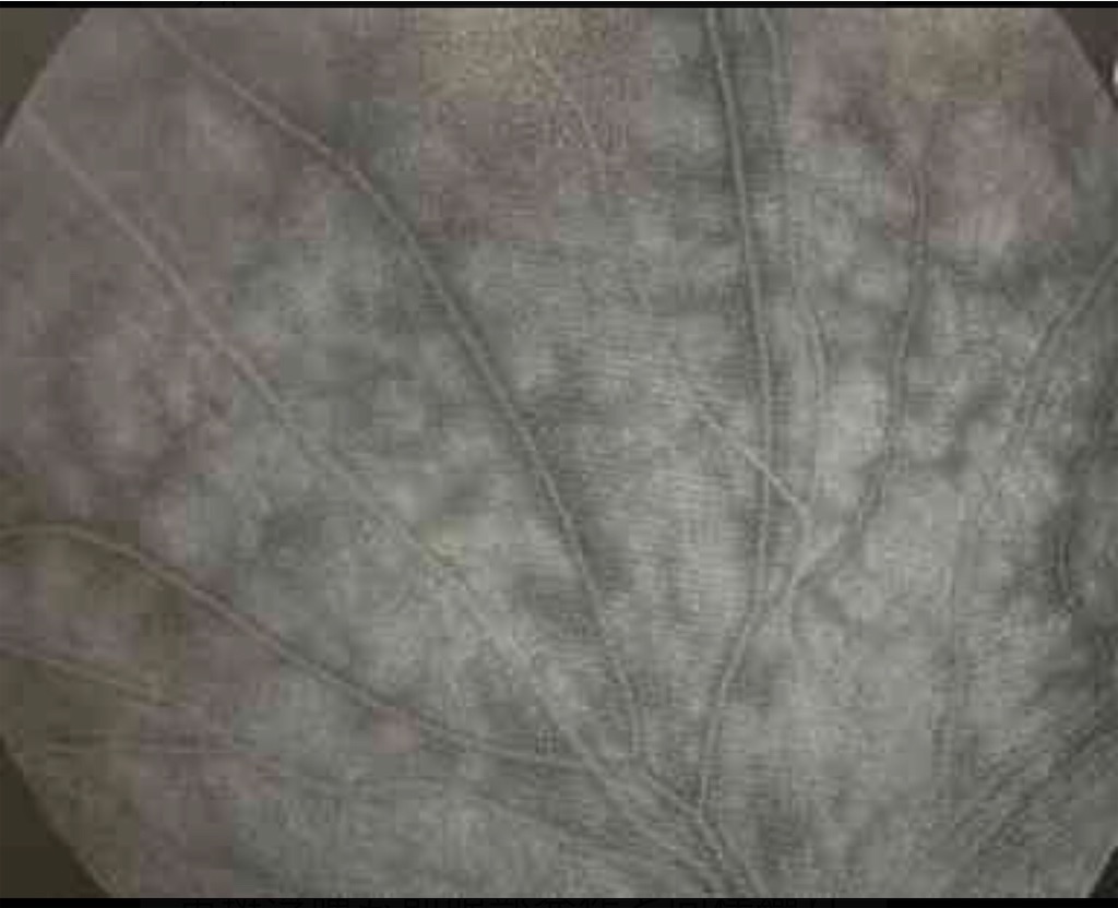f:id:xharu14:20200804000855j:image f:id:xharu14:20200804000855j:image