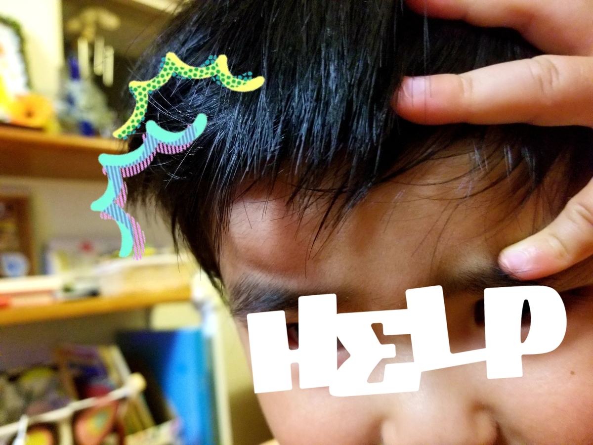 2歳8ヵ月 でっかいたんこぶ たんこぶくらい と侮るべからず１週間は様子見 ゆーんの徒然日記