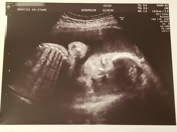 f:id:xoyu-nxo:20200523231223j:image f:id:xoyu-nxo:20200523231223j:image