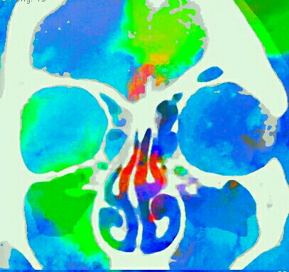 f:id:xrayrayray:20160519205644j:image f:id:xrayrayray:20160519205644j:image