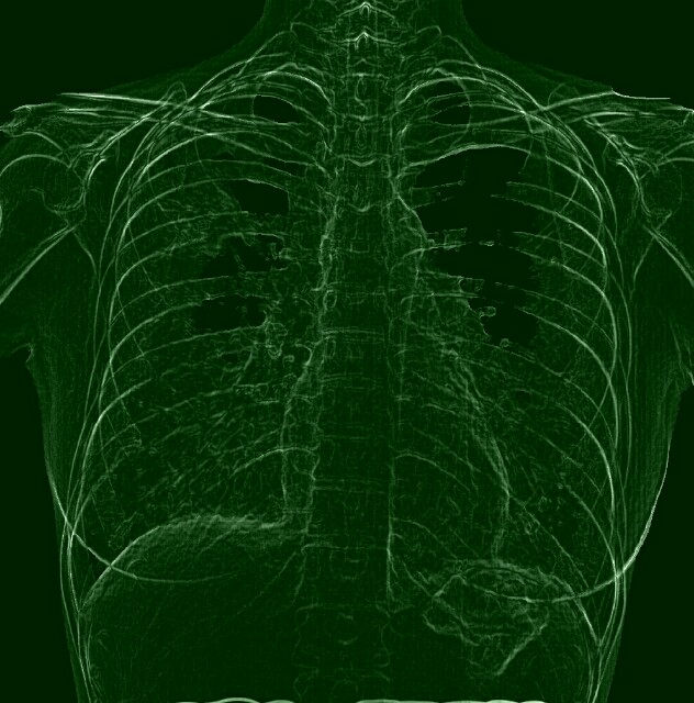 f:id:xrayrayray:20160521090151j:image f:id:xrayrayray:20160521090151j:image