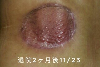 f:id:xun-dfsp:20161229165344j:image f:id:xun-dfsp:20161229165344j:image
