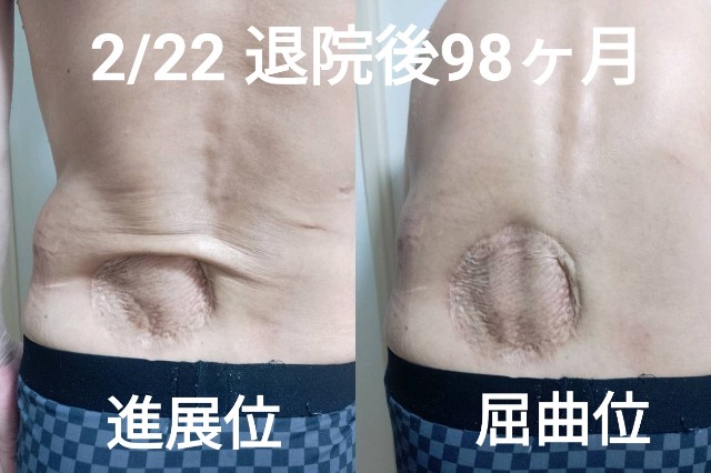 f:id:xun-dfsp:20250223011908j:image