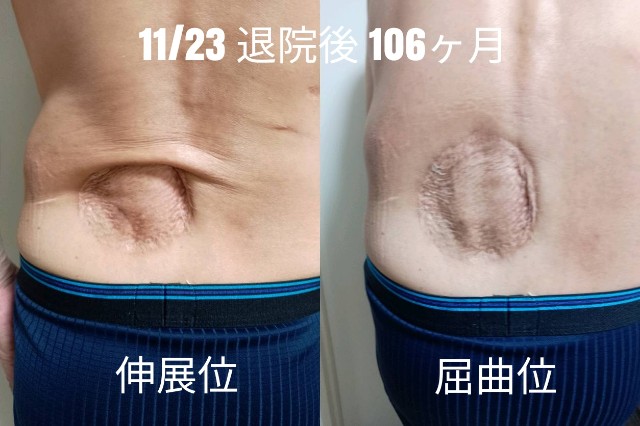f:id:xun-dfsp:20251123114756j:image