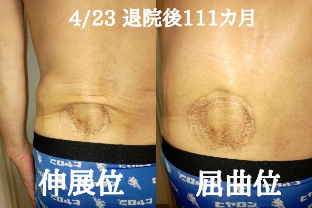 f:id:xun-dfsp:20260423203028j:image