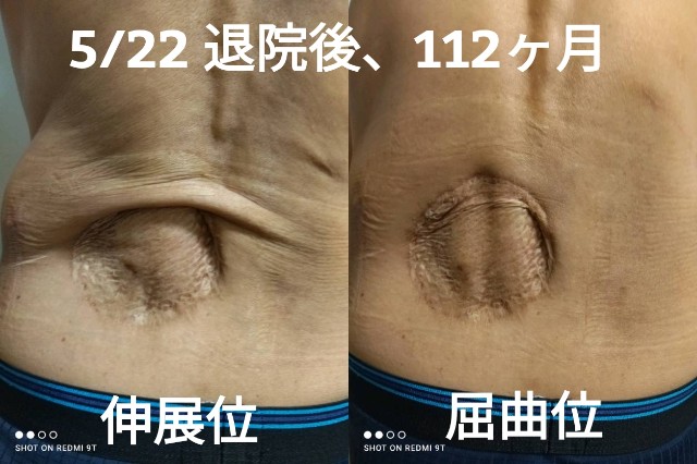 f:id:xun-dfsp:20260522201427j:image