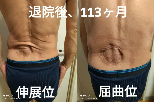 f:id:xun-dfsp:20260622182559j:image
