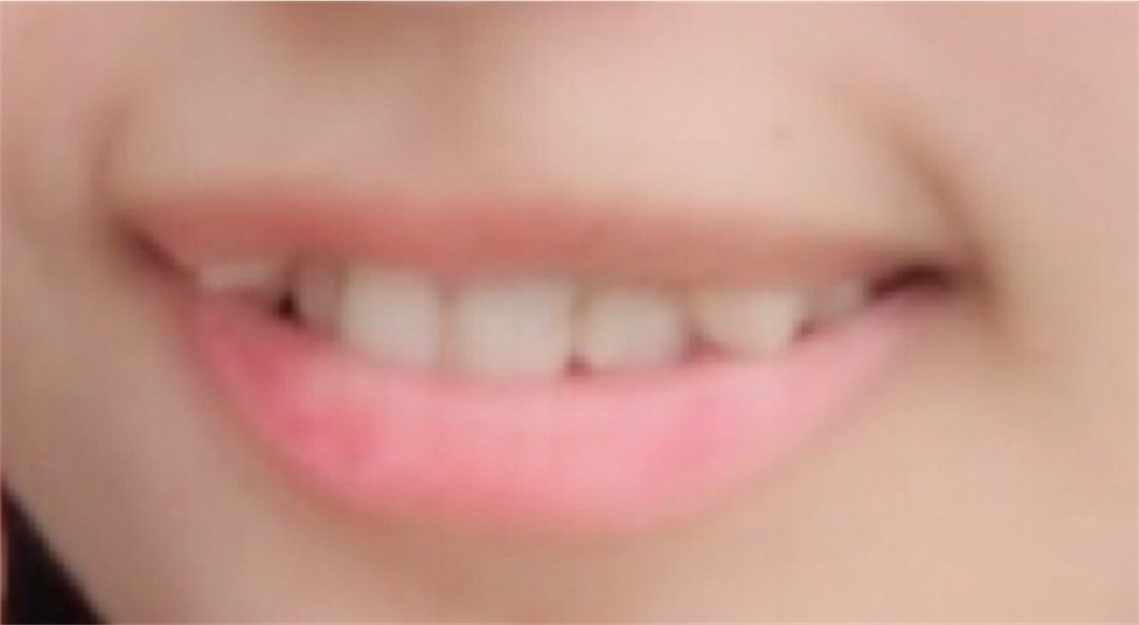 f:id:xx_no_money:20190314223429j:image f:id:xx_no_money:20190314223429j:image