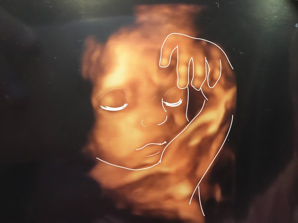 ちょっと怖かった妊娠中の４ｄエコー写真 でも産後に見返してみると かわいいー By ちい ゼクシィbaby 妊娠 出産 育児 みんなの体験記