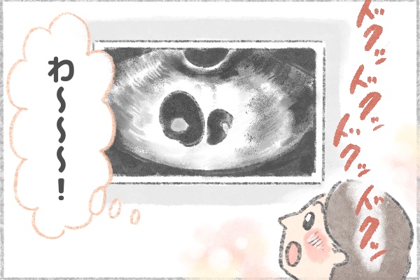 妊娠6週頃にふたつの心拍を確認 双子の妊娠がわかってびっくり By さくらいえま みんなの体験記 妊娠 出産 育児 妊娠6週頃にふたつの心拍を確認 双子の妊娠がわかってびっくり By さくらいえま みんなの体験記 妊娠 出産 育児