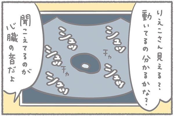 チカチカと小さく動く光・・・長く感じた妊娠7週の健診で心拍確認 