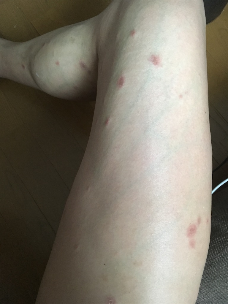 f:id:yacchin-1129:20190512041958j:image f:id:yacchin-1129:20190512041958j:image