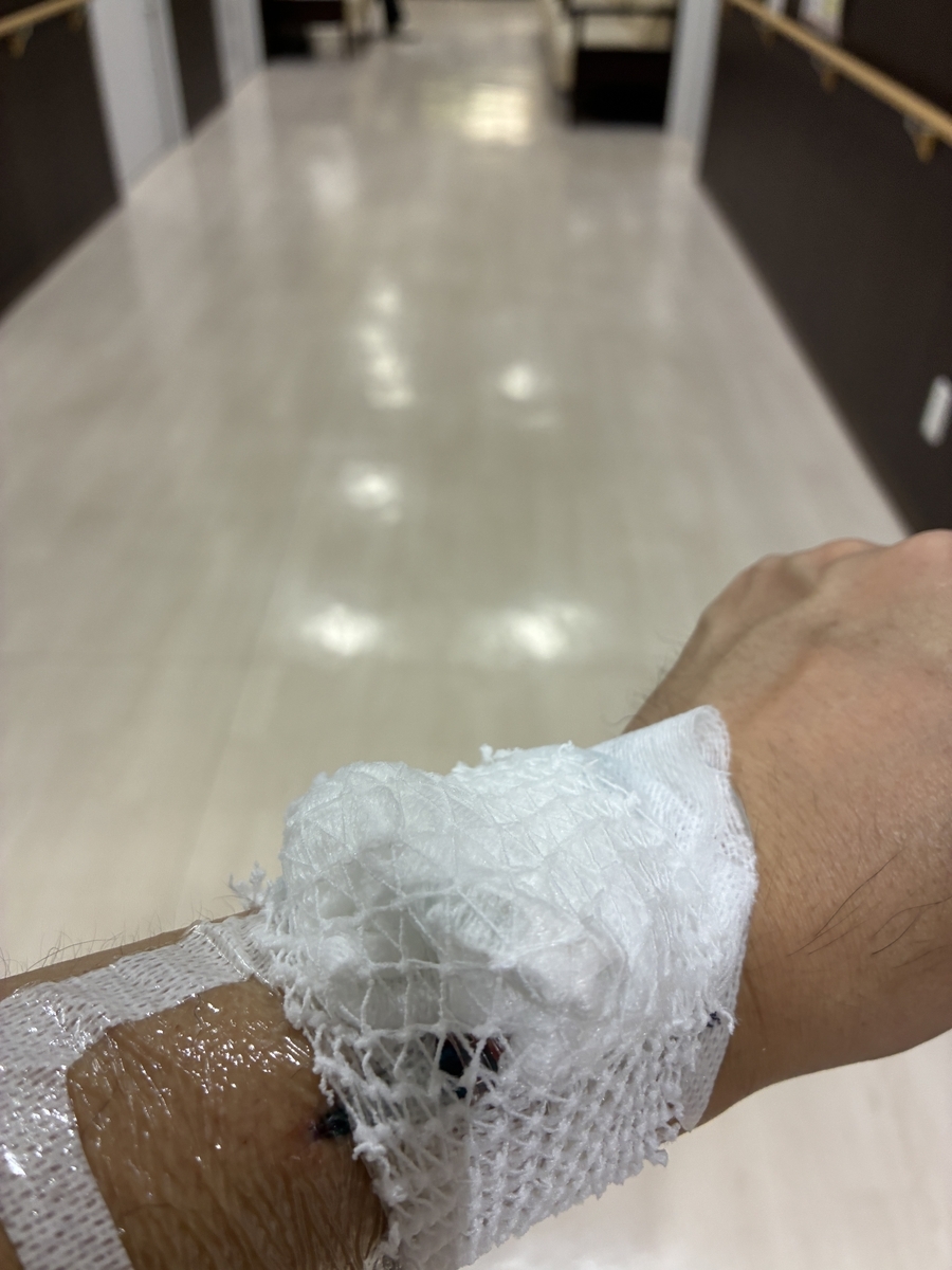 点滴ルートを確保した腕
