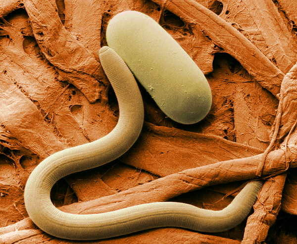 線虫でがん検査 尿一滴でがんの早期発見が可能に Yakudacchi 生活の知恵 裏技など お得な情報をご紹介