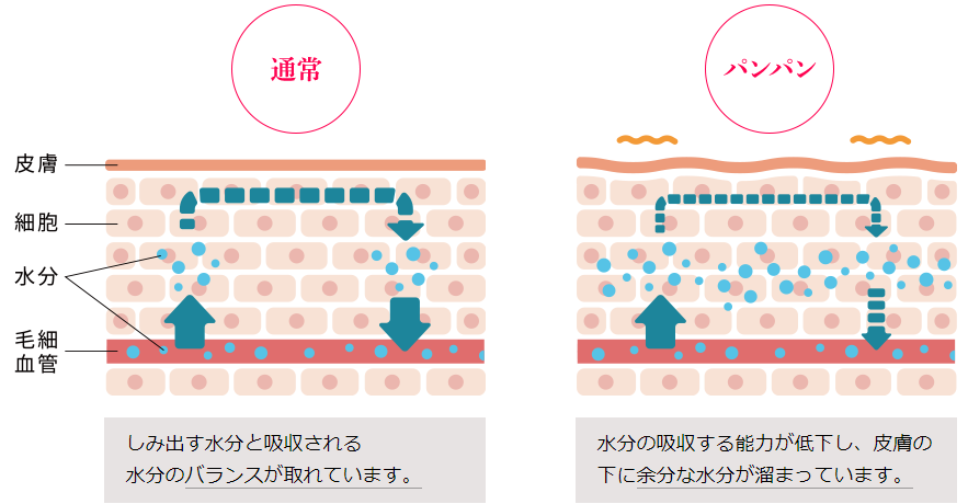 f:id:yakudacchi:20210409172918p:plain