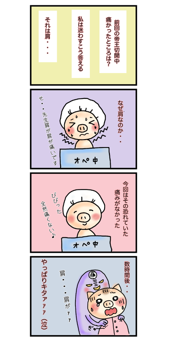帝王切開の痛みについての4コマ漫画